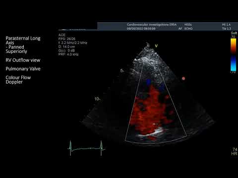 Standard TTE Protocol