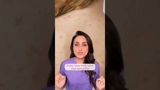 Back acne | how to treat | what to avoid