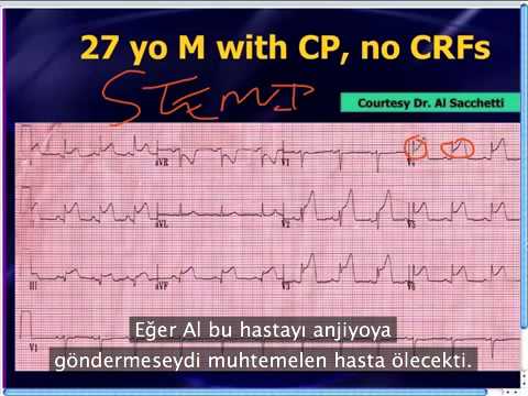 Mattu EKG Vakası: ST Elevasyonunda Ayırıcı Tanı - 3 Haziran 2013 (Türkçe Altyazılı)