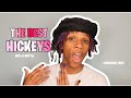 HOW TO GIVE THE BEST HICKEYS DO S DON Ts REMOVAL