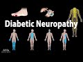 Diabetic Neuropathy Animation