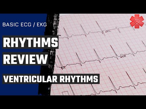 Basic ECG/ EKG Part 4: Ventricular Rhythms
