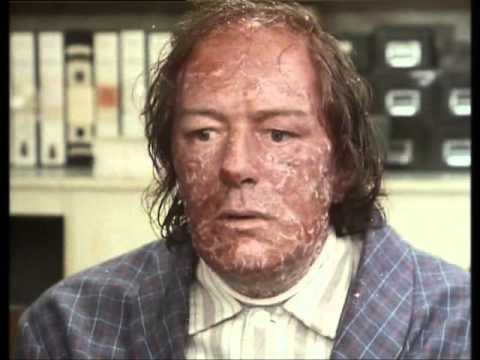 singing detective Heat part 2