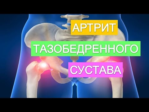 Мр картина дистрофических изменений поясничного отдела позвоночника остеохондроз Трещит челюстной сустав