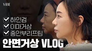 [성형 VLOG] 성형 고민이라면 필수 시청! 안면거상 풀 과정 브이로그｜이마거상, 안면거상, 하안검, 중안부리프팅