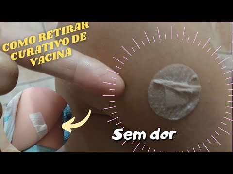 Como retirar curativo sem machucar a criança. 🩹 💉
