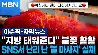 [자막뉴스] ＂지방 태워준다＂ 불꽃 활활…SNS서 난리 난 '불 마사지' 실체 | 이슈픽