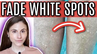 How to FADE WHITE SPOTS from SUN DAMAGE | Dr Dray