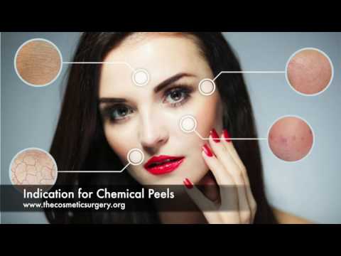 download lagu mp3 mp4 Cost Of Chemical Peel At Dermatologist India, download lagu Cost Of Chemical Peel At Dermatologist India gratis, unduh video klip Cost Of Chemical Peel At Dermatologist India