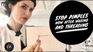 Stop ⛔️acne after waxing and threading- tips by Dr Liv