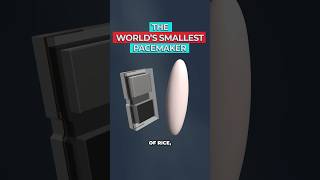 Engineers Just Created the World's Smallest Pacemaker