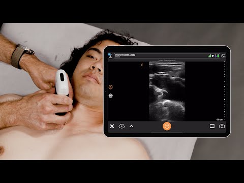 Ultrasound for Subclavian Central Line Placement
