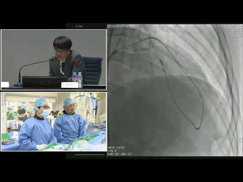 [TCTAP 2018] Master the CTO - Live Case Session IV