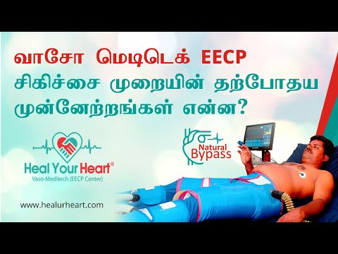 வாசோ மெடிடெக் EECP சிகிச்சை முறையின் தற்போதய முன்னேற்றங்கள் என்ன?