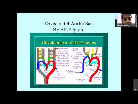 Cono Truncal Anomalies of CHD 4 by Dr JAYA R DESHPANDE