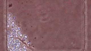 Human neutrophils interacting with Aspergillus fumigatus