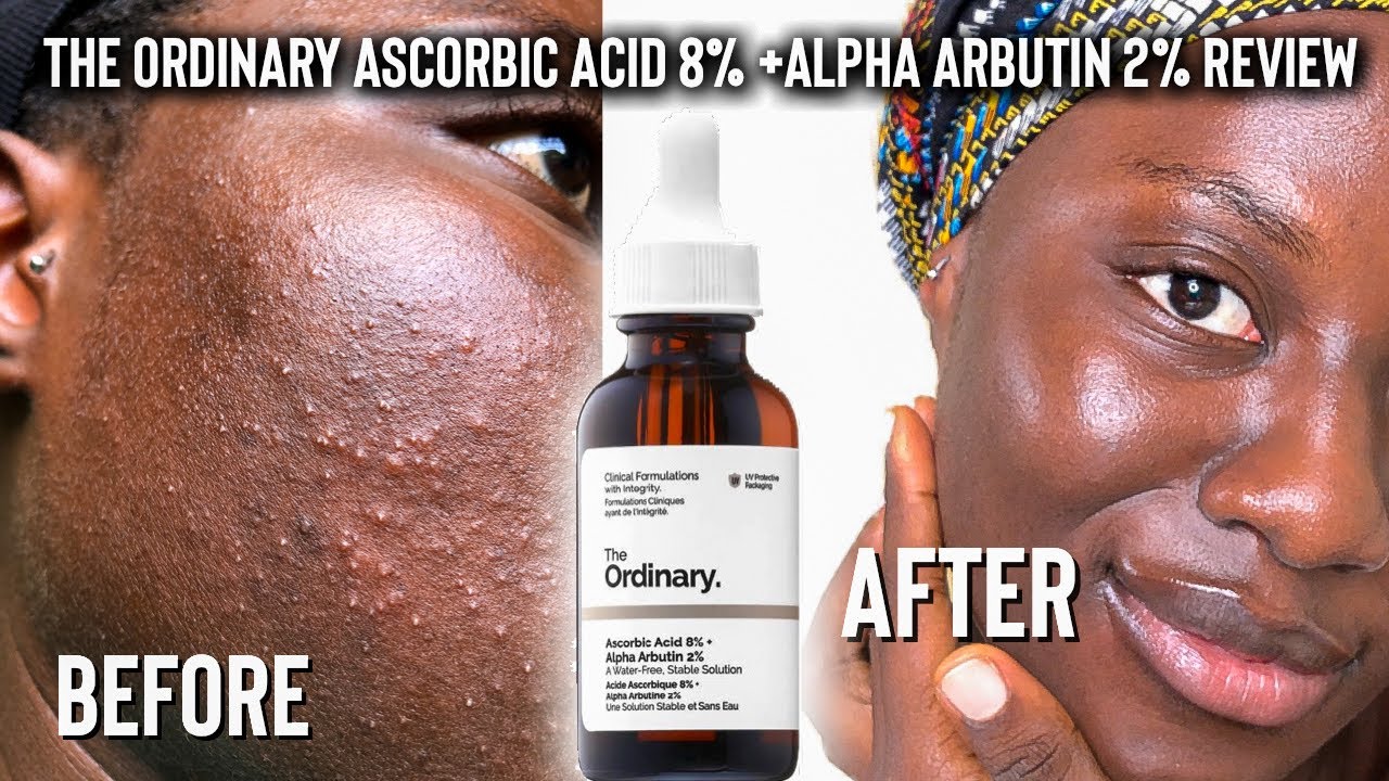 THE ORDINARY ASCORBIC ACID 8% + ALPHA ARBUTIN 2% VITAMIN C SERUM INDEPTH REVIEW