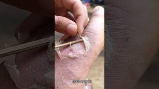 Download lagu MANG UNI'S FOOT WAS STICKED BY A NAIL, BESTIEEE mp3 Download lagu MANG UNI'S FOOT WAS STICKED BY A NAIL, BESTIEEE mp3