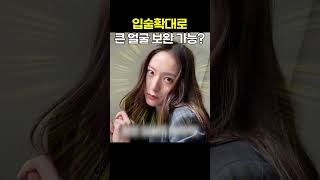 턱 확대술 성형 시술