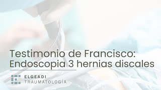 Cirugía de 3 hernias discales mediante endoscopia avanzada de columna en Madrid