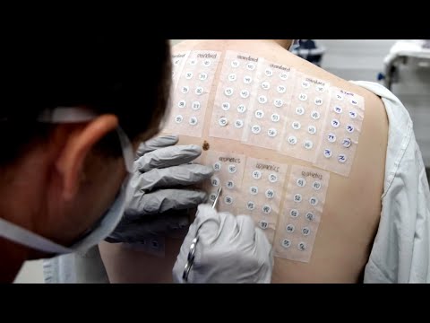 YouTube video about Discovering What a Skin Patch Test Involves
