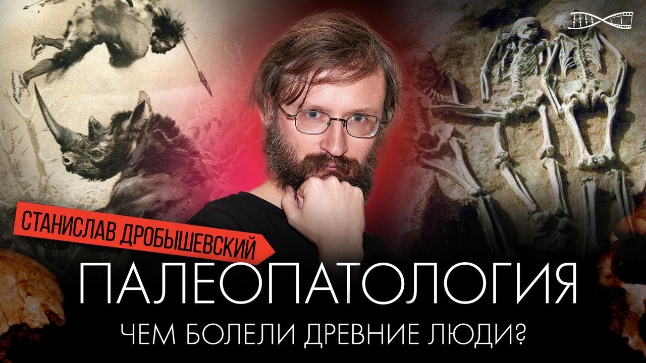 Чем болели наши предки | Станислав Дробышевский