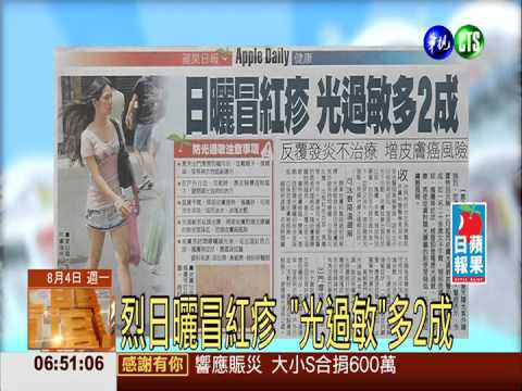 烈日曬冒紅疹 "光過敏"多2成