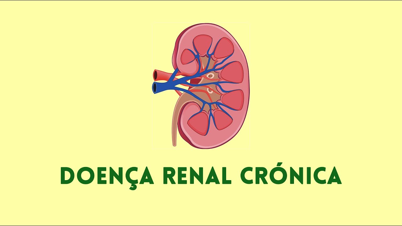 Doença Renal Crónica - Fisiopatologia, Complicações e Abordagem