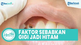Faktor Risiko Warna Gigi Menjadi Hitam, dari Stain Gigi hingga Karies