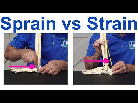 Sprain vs Strain: Understanding the Key Differences
