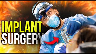 Dental Implant Surgery: How I Place Full Arch Dental Implants