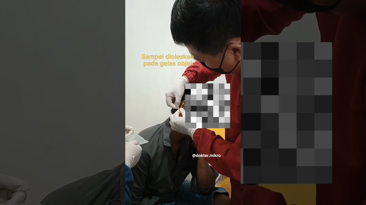 Pemeriksaan Lepra (Kusta): kerokan kulit dilihat di bawah mikroskop. Tampak BTA (basil tahan asam).