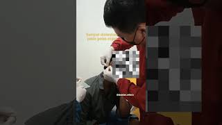 Download lagu Pemeriksaan Lepra (Kusta): kerokan kulit dilihat di bawah mikroskop. Tampak BTA (basil tahan asam). mp3