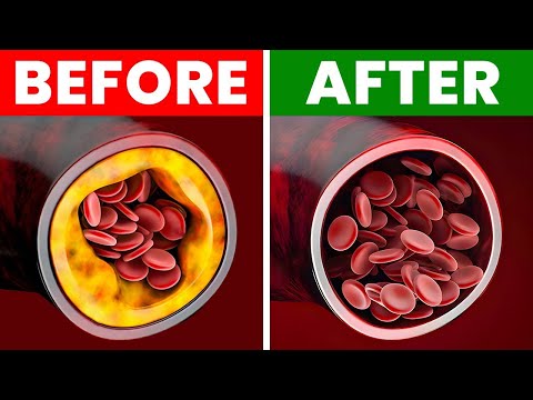 Yellow Bumpy Patches Around the Eyelids