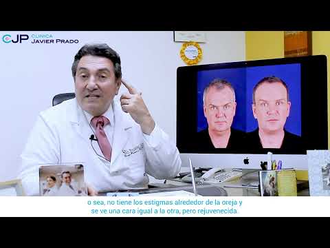 Dr. Andy Wiegering - Rejuvenecimiento facial