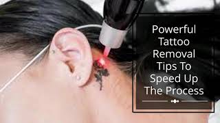 Powerful Tattoo Removal Tips To Speed Up The Process