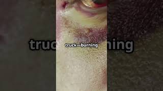 Surviving Lightning Strikes - Roy Sullivan's Electric Tale!