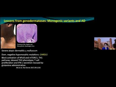 Global Dermatology Talks 2-16-2023 Amy Paller