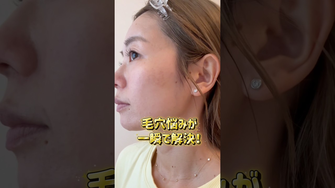 【鈴木あや】で検索してTiktokやInstagram遊びにきてね😗✨　#毛穴 #毛穴ケア