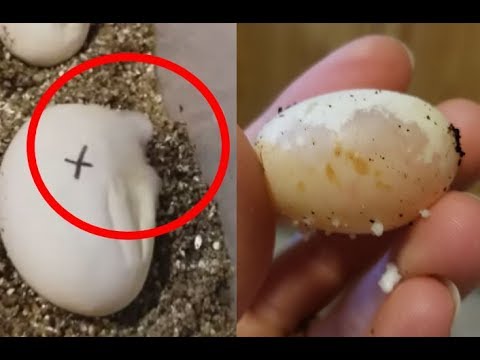 Matapang na kape para sa paggamot ng kuko halamang-singaw Tradisyunal na medisina ng halamang-singaw sa mga kuko ng mga kamay