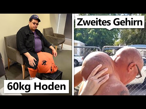 8 Menschen, denen unglaubliche Körperteile wachsen