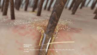 Head & Shoulders Continuous Use