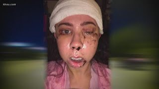 Woman beaten disfigured by man who tried to rape h