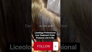 Removing lice from dark hair #lice #piojos # #nitpicking #hair
