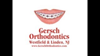 Gersch Orthodontics Harlem Shake - Take #2!