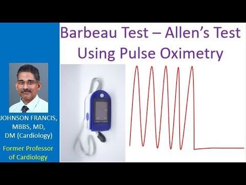 Barbeau Test – Allen’s Test Using Pulse Oximetry