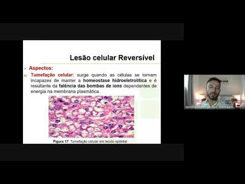 Aula 07: Lesão reversível e Mecanismos de lesão celular