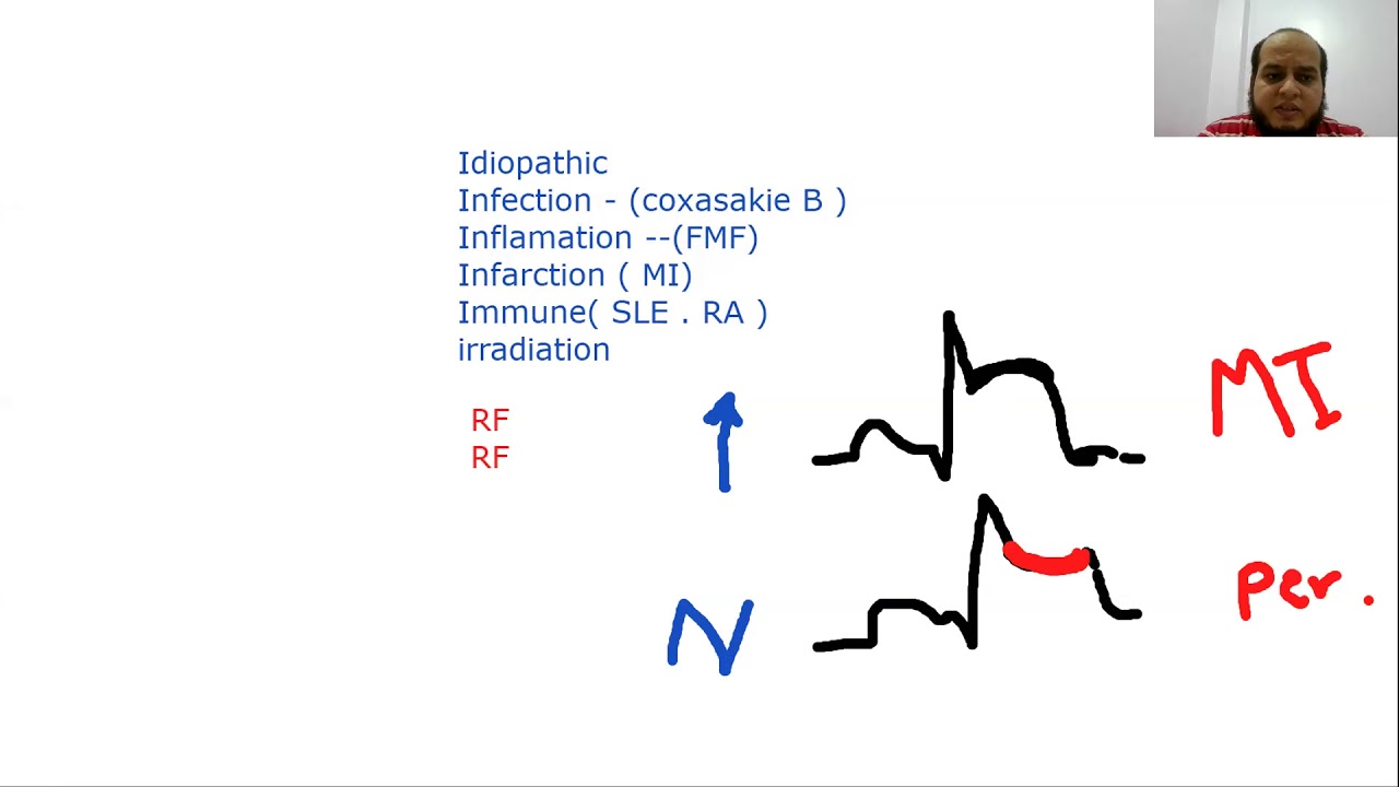 معادلة امريكية بالعربي Toxic USMLE ( CVS miscellaneous A) Ibrahem gamalابراهيم جمال
