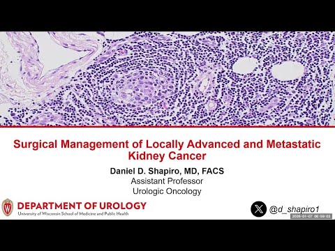 UW Urology Grand Rounds: Surgery for Locally Advanced and Metastatic Kidney Cancer 1/7/2026