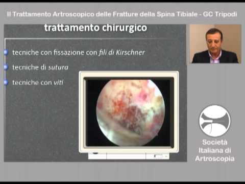 Infiammazione delle articolazioni nella foto mano Quando mal di schiena dopo il parto